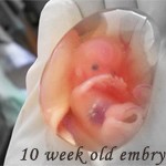 10weekoldembryo-smlr